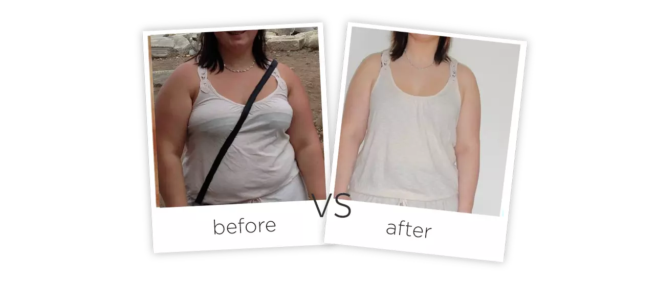 Cooling Cryolipolysis Machine Treatment Before&After